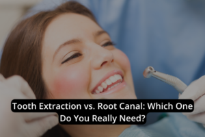 Tooth Extraction vs. Root Canal: Which One Do You Really Need ...